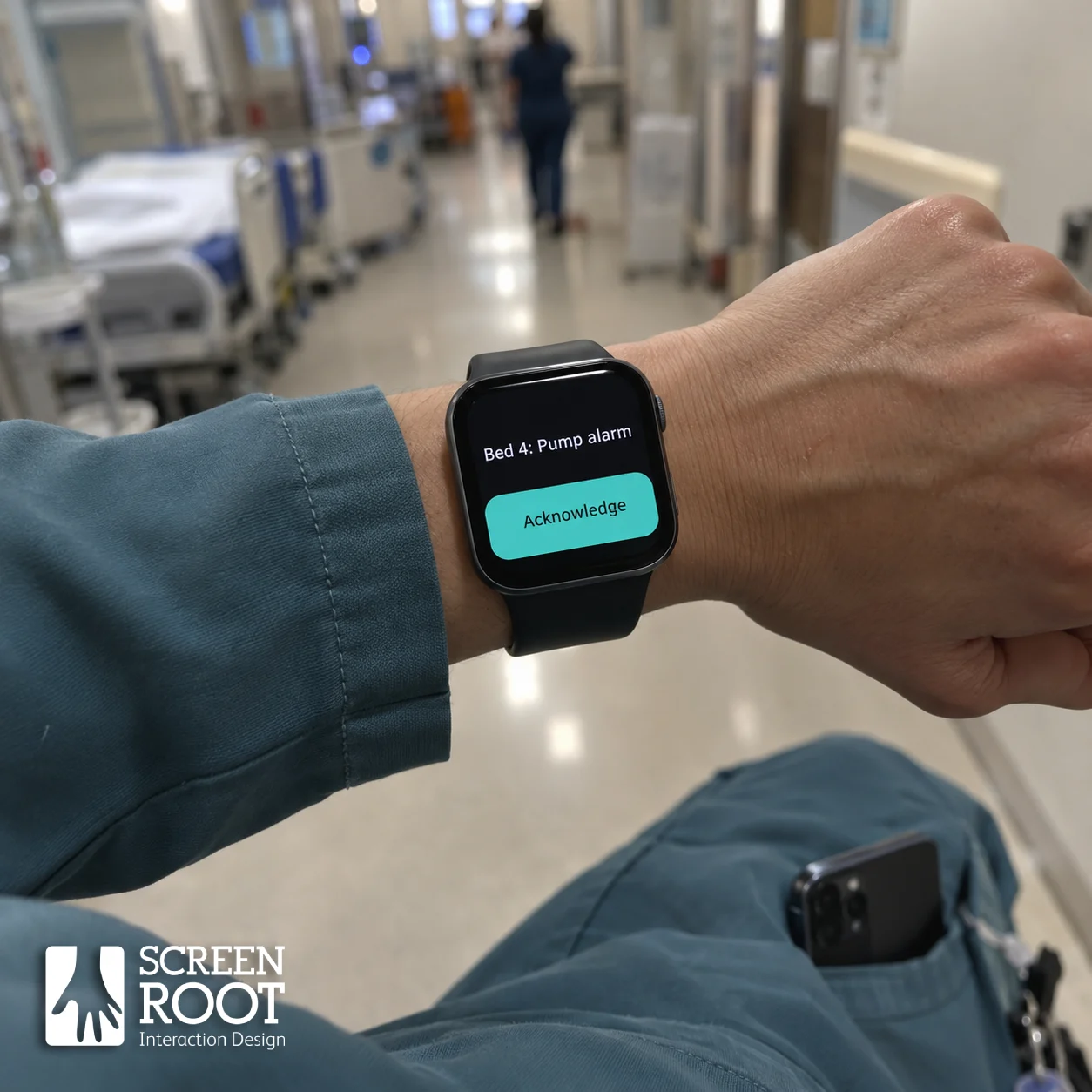 Nurse glancing at a smartwatch showing one pump alarm and a single Acknowledge button, illustrating glanceable utility in high-stakes wearable UI design